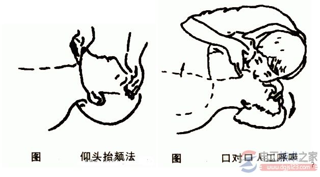 触电急救方法及注意事项有哪些