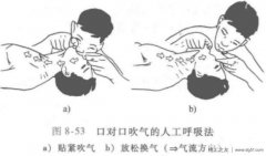 触电急救之人工呼吸法