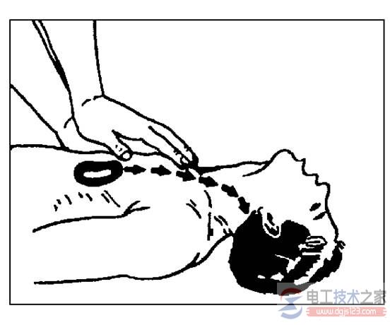 人体触电的常规表现，人体触电的急救措施