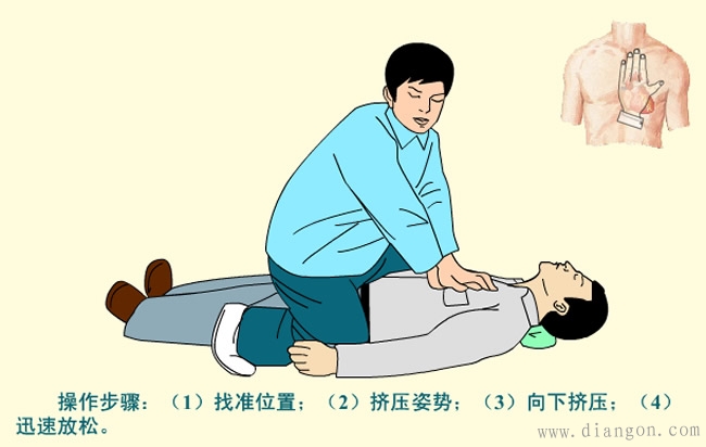 电工必需知道的触电急救方法 电工必需知道的触电急救方法