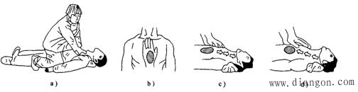 触电急救常识和触电急救方法 触电急救常识和触电急救方法