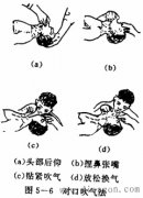 触电人工呼吸法抢救技术