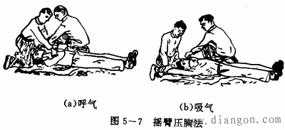 触电人工呼吸法抢救技术
