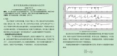 数字低通滤波器在活套控制中的应用