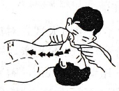 发现有人触电后如何进行人工急救