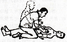 人工呼吸法或胸外心脏挤压法进行急救雷击或触电者