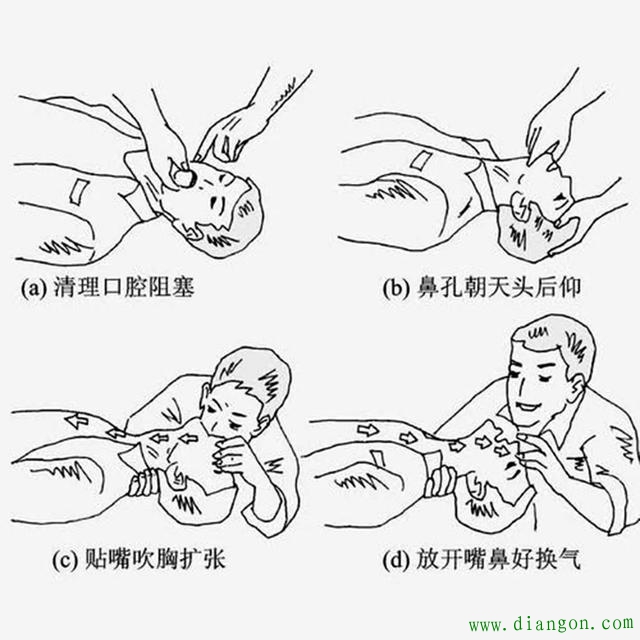 人体触电如何急救?对触电者进行人工呼吸时应注意什么? 人体触电如何急救?对触电者进行人工呼吸时应注意什么?
