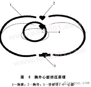 触电急救方法