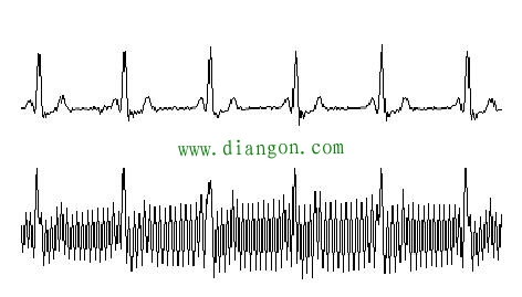 影响模拟量传感器的外界干扰因素和抗干扰措施