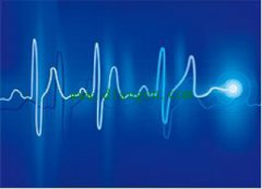 谐波对电缆的危害