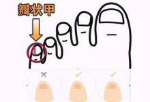小脚趾甲两瓣是什么民族
