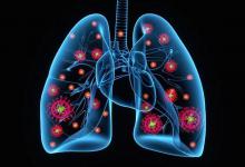 常年吸烟的人，若出现“2痛1红”，可能是肺撑不住了