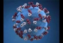 放开后买不到连花清瘟？钟南山：增强免疫力是关键，要多吃这4样