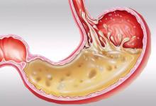 奥美拉唑，是饭前吃还是饭后吃？长期服用，会给身体带来副作用吗