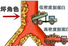 血脂高的人不能吃面条？提醒：若想稳定血脂，要及早远离6种素食