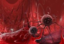 癌细胞“讨厌”4种食物？平时多吃点，或能让癌细胞远离你