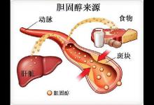 高胆固醇食物公布，蛋黄排最后，榜首很多人经常吃