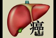 肝癌为何越来越多？提醒：1种水果或比酒精伤肝，别不听劝