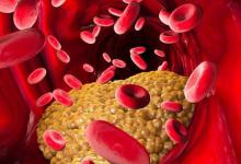 核桃，是甘油三酯的“催化剂”吗？内科主任：稳定血脂，远离7物