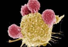 睡觉时如果出现这3种情况，建议及早就医