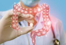 肠癌到来时难发现？提醒：平时要注意这4种情况