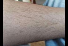 女性这4处毛发旺盛，是好事还是坏事？或许很多人还不知道