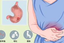 食物中的“奥美拉唑”被发现，提醒：敞开吃，或能养出强壮胃