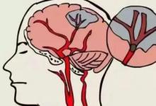 58岁男子，深夜脑梗瘫痪，提醒中老年人：晚饭后尽量少做这4件事