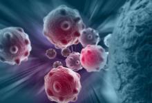 确诊癌症后，化疗与不化疗，哪个活得更久？肿瘤医生告诉你实话