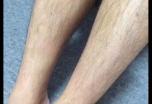 为什么有的女性体毛旺盛，有的却“光秃秃”？终于找到原因了