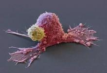 “一级致癌物”公布，世卫组织呼吁：或比烟酒伤肝，请管住嘴