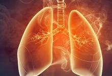 肺部出问题，喉咙先知？提醒：喉咙出现6个信号，要及早做检查