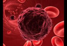 研究癌症60年，中工院院士发现最好的“抗癌运动”，医生纷纷打卡