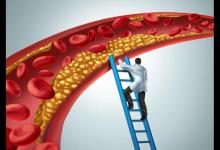 73岁老人血脂从7.3到1.3，分享：降血脂不是多运动，关键是3件事