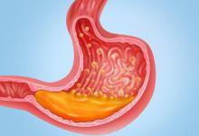 胃病不能喝小米粥？医生提醒：想养好胃，平时少碰这4物