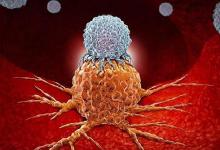 中国癌症高发，和滥用食品添加剂有关？提醒：4种添加剂要早远离