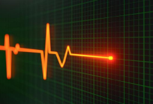 为啥很多女生体检都t波改变