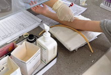 无创dna是检查什么的