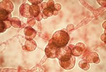 致命真菌在美国蔓延的原因主要是什么