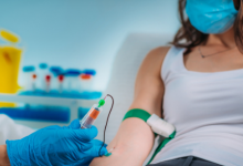 无创dna需要空腹吗