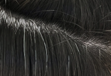 白发多经常补染可以吗