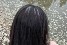 白头发看中医挂什么科