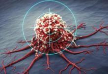 ​中国“癌症地图”出炉如何降低得癌症风险？