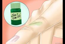 怎么处理纸造成的割伤