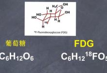 反物质的应用：正电子发射断层扫描