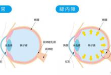 眼睛为什么能看见东西？