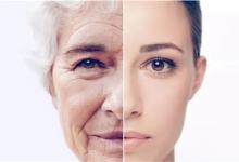 导致皮肤老化的重要蛋白发现是那种类型重要蛋白