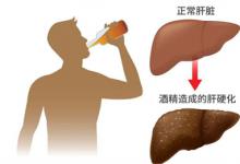 60多种疾病“缠身”与喝酒有关喝酒对身体危害有哪些