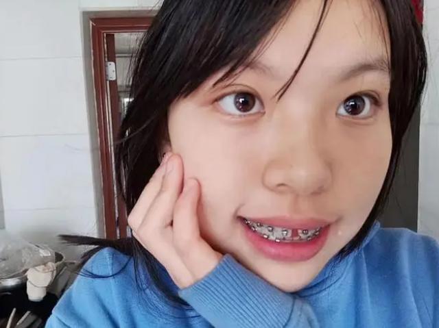 学生热议"看牙猜贫富",牙套妹成热门话题_文化教育_中睿百科网