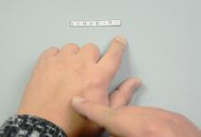 脸上长色斑又难看又显老！教你一个土方法，轻松淡化祛斑显白嫩